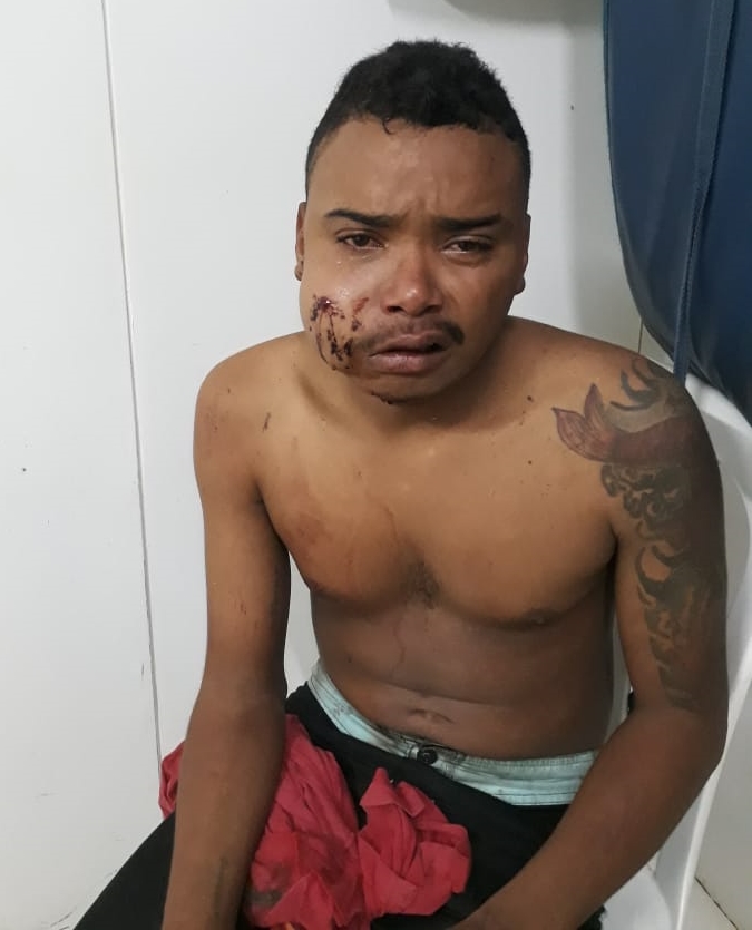 Lázaro Almada Martins da Silva foi linchado por populares após roubar uma motocicleta.