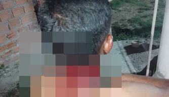 Jovem sofre corte profundo no pescoço durante briga com irmão em José de Freitas