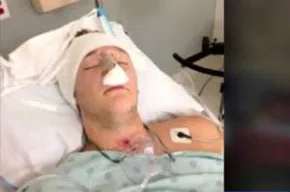 Chance Bothe, 21, hospitalizado após bater o carro